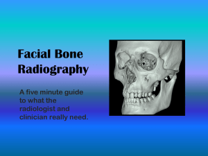 Facial Bones Power Point