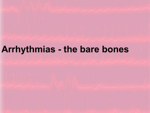 The Basics of Arrhythmia