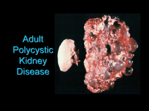 Adult Polycystic Kidney Disease (APKD) Overview