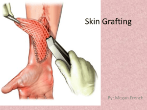 Skin Grafting: Procedure, History & Complications