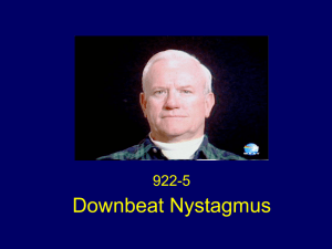 Downbeat Nystagmus