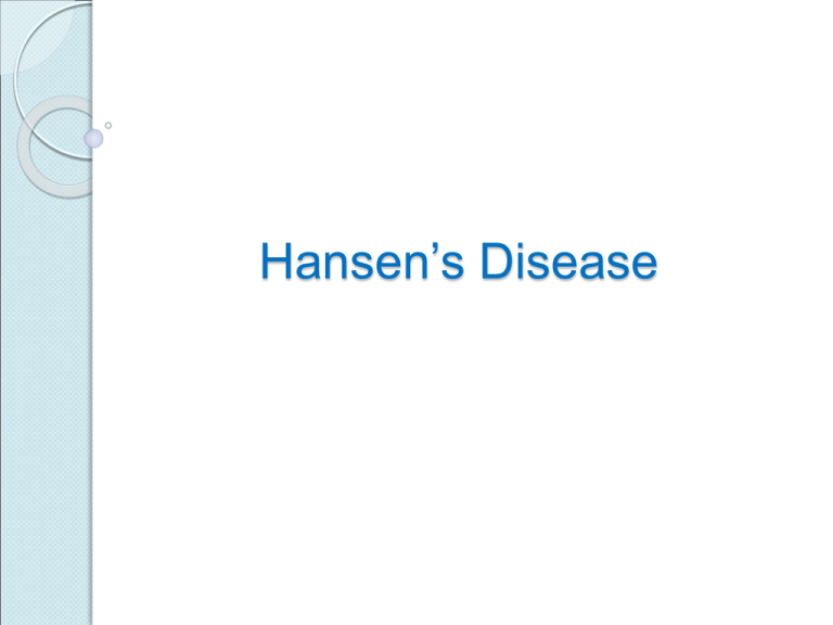 hansen