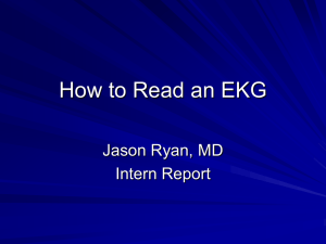 How to Read an EKG