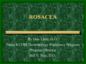 rosacea