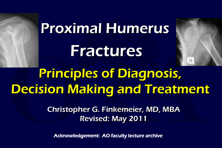 Proximal Humerus Fractures: Diagnosis & Treatment