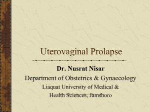 Uterovaginal Prolapse: Causes, Diagnosis & Treatment