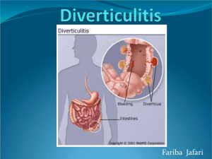 Diverticulitis