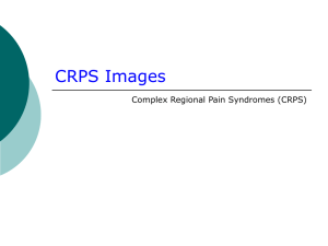 CRPS Images - CatsTCMNotes