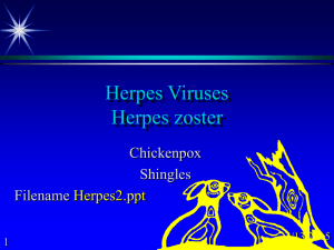 Herpes Zoster: Chickenpox & Shingles Presentation
