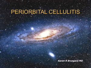 CELLULITIS
