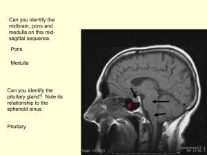 MRI Anatomy: Brain, Sinuses, and Extra-Ocular Muscles