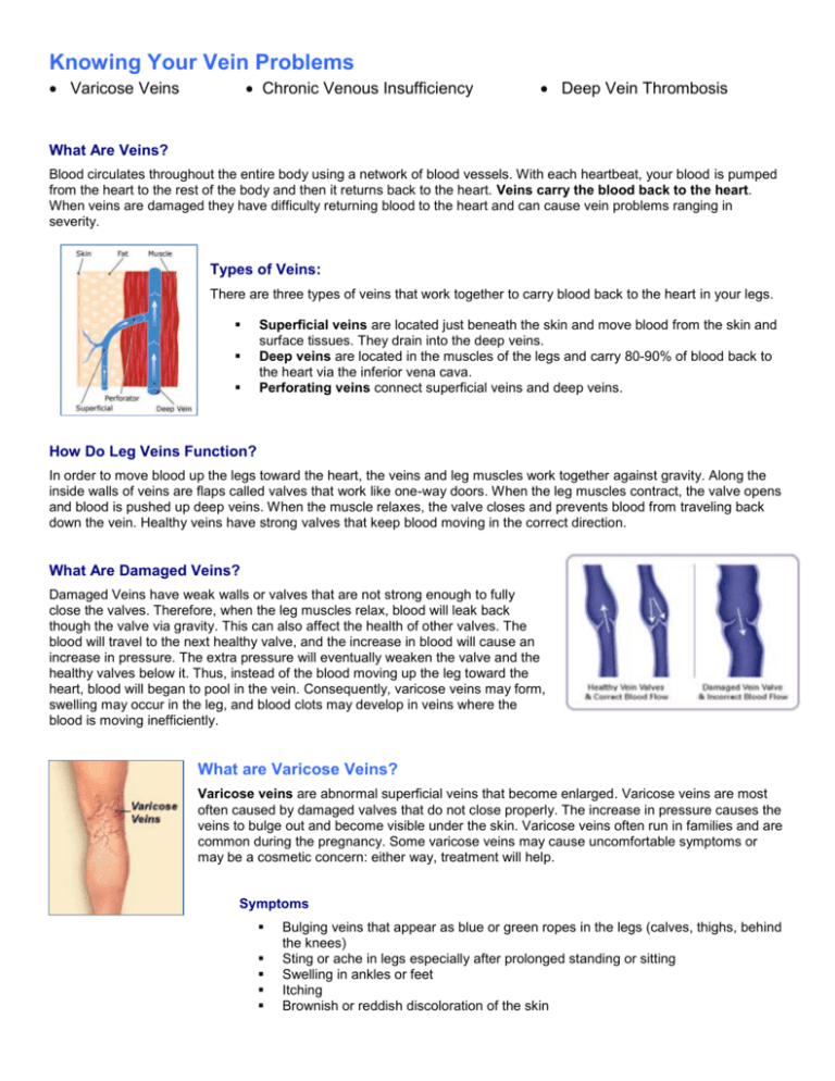 Varicose Veins Middlesex Surgical Associates