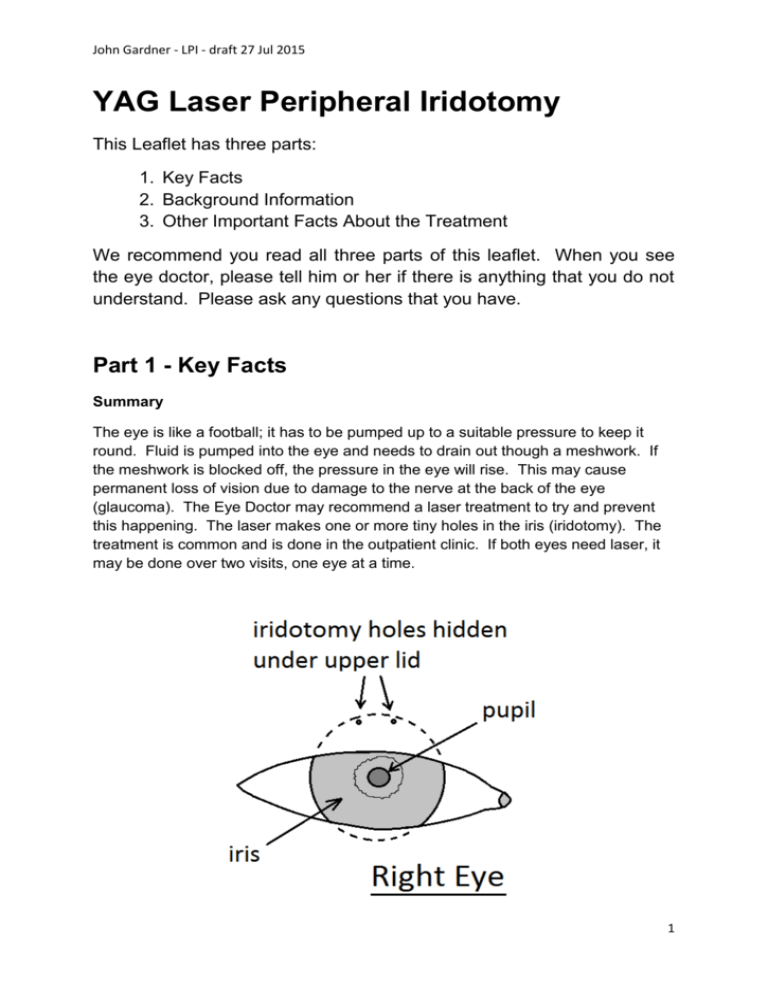 Laser Peripheral Iridotomy Procedure Note at Karen Leonard blog