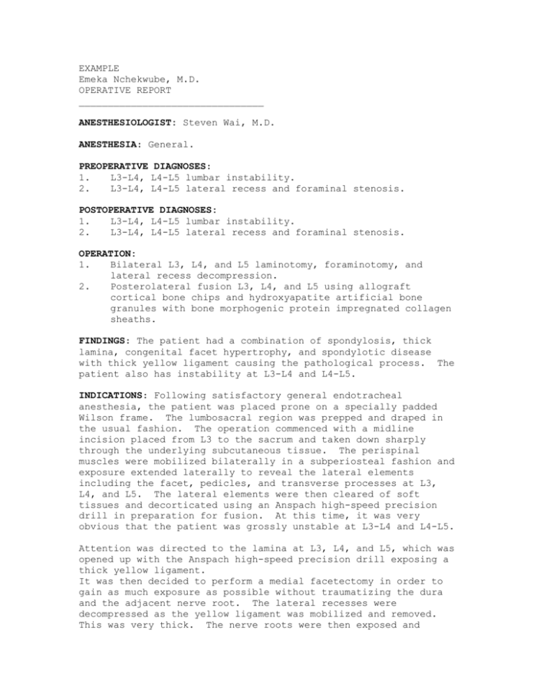 EXAMPLE - Acusis