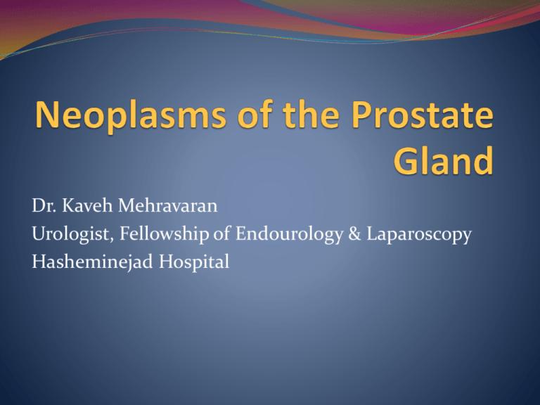 neoplasms-of-the-prostate-gland