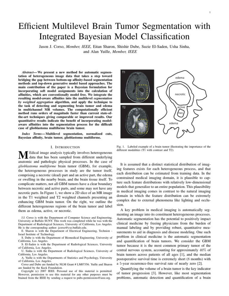 Efficient Multilevel Brain Tumor Segmentation With Integrated Bayesian ...