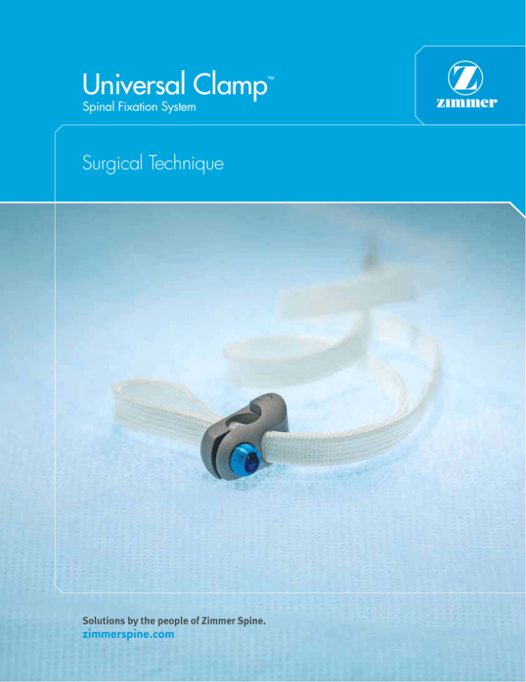 Universal Clamp™