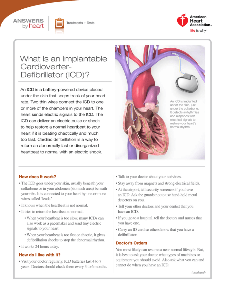 What Is An Implantable Cardioverter