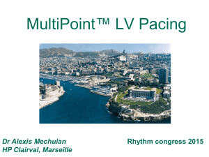 MultiPoint™ Pacing - Rhythm congress 2017