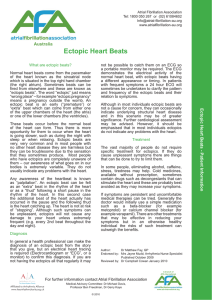 Ectopic Heart Beats - Atrial Fibrillation Association