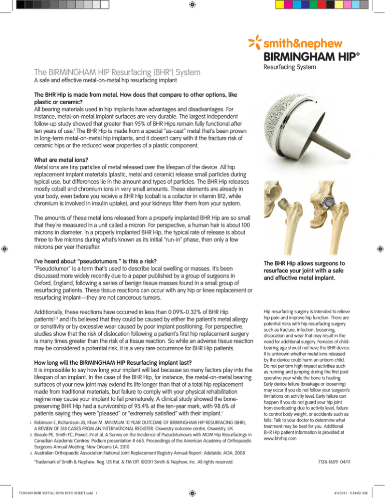 The BIRMINGHAM HIP Resurfacing (BHR™) System