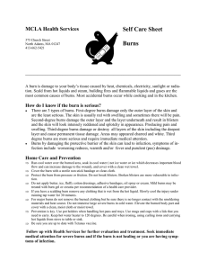 Burns - MCLA