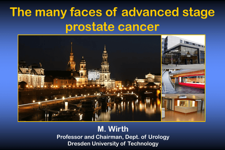 the-many-faces-of-advanced-stage-prostate-cancer