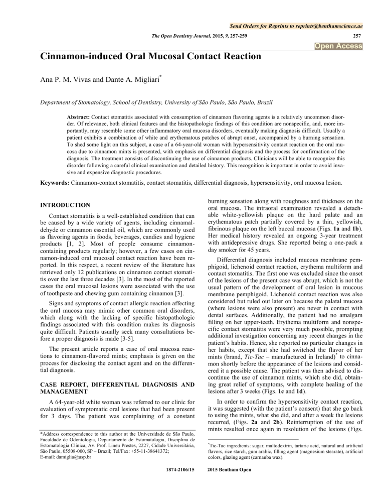 Cinnamoninduced Oral Mucosal Contact Reaction