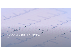 Advanced Dysrhythmias: ECG Interpretation & Treatment