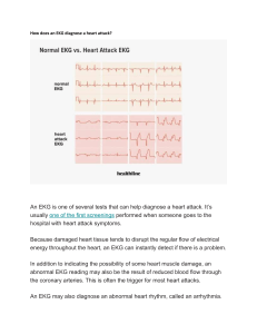 EKG for Heart Attack Diagnosis